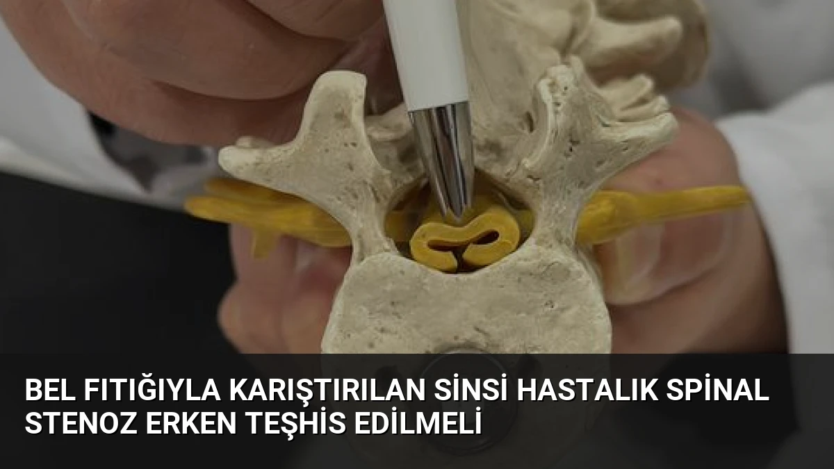 Bel Fıtığıyla Karıştırılan Sinsi Hastalık Spinal Stenoz Erken Teşhis Edilmeli