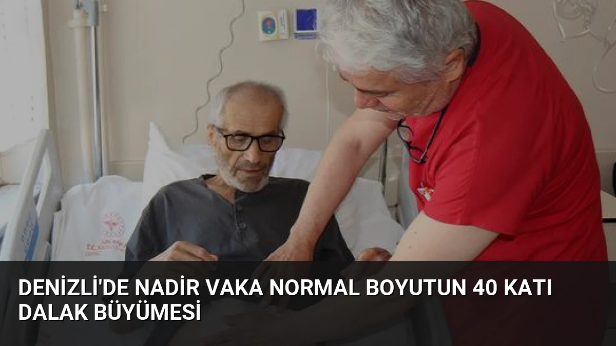 Denizli’de Nadir Vaka Normal Boyutun 40 Katı Dalak Büyümesi