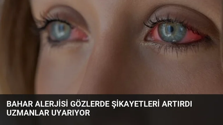 Bahar Alerjisi Gözlerde Şikayetleri Artırdı Uzmanlar Uyarıyor