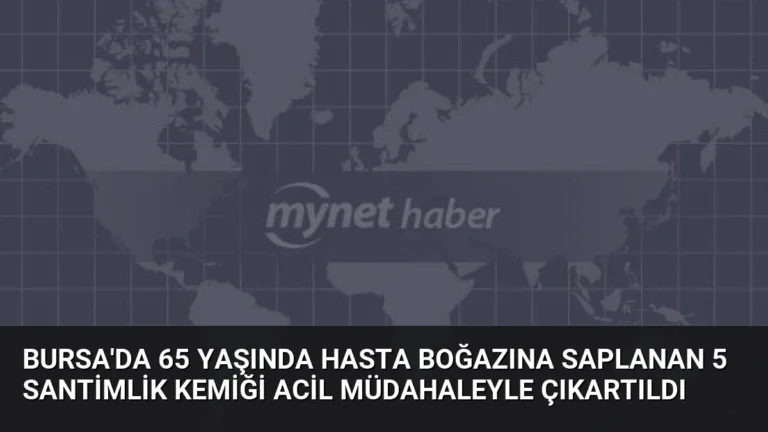 Bursa’da 65 Yaşında Hasta Boğazına Saplanan 5 Santimlik Kemiği Acil Müdahaleyle Çıkartıldı