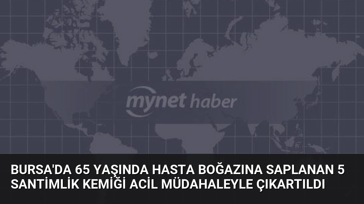 Bursa’da 65 Yaşında Hasta Boğazına Saplanan 5 Santimlik Kemiği Acil Müdahaleyle Çıkartıldı