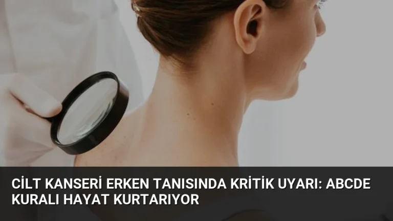 Cilt Kanseri Erken Tanısında Kritik Uyarı: ABCDE Kuralı Hayat Kurtarıyor