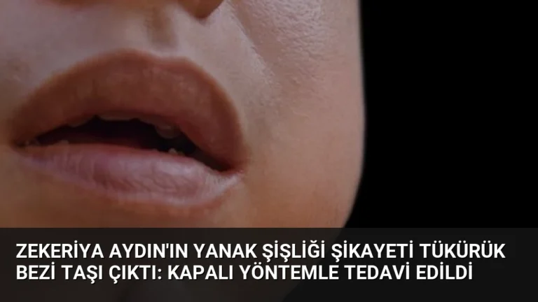 Zekeriya Aydın’ın Yanak Şişliği Şikayeti Tükürük Bezi Taşı Çıktı: Kapalı Yöntemle Tedavi Edildi
